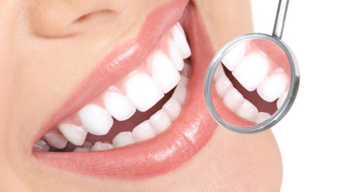 Tips para blanquear los dientes